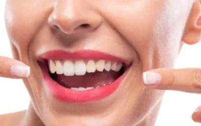 Rahasia Gigi Tetap Putih dengan Pepsodent Ultra White Spray